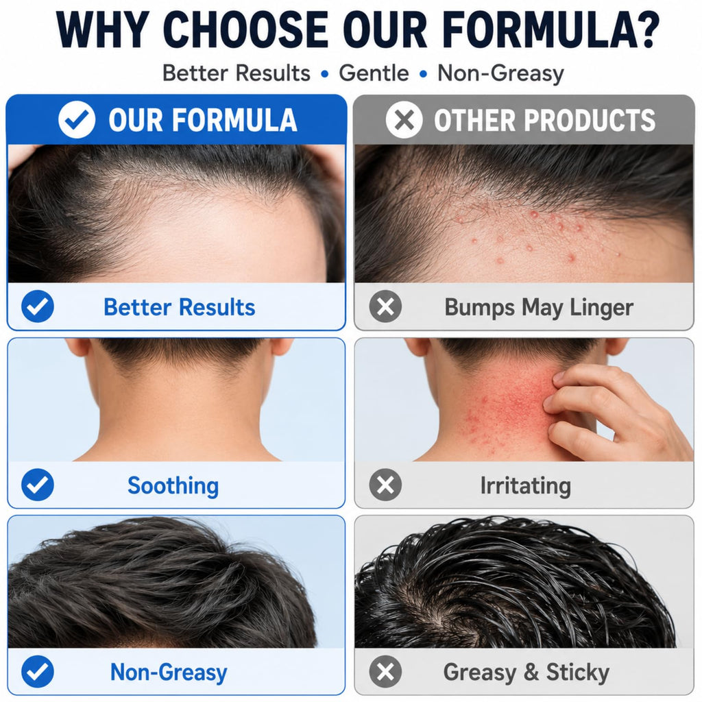 Folliculitis Treatment Cream, 5% Benzoyl Peroxide & Tea Tree Oil, 100g