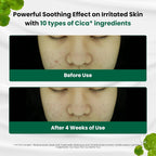 Buy now Dr.G Red Blemish Clear Soothing Korean Moisturizer Face Cream, 70ml - Cica Cream, Korean Skin Care Moisturizer, Korean Face Moisturizer, Facial Moisturizer, Korean Skincare, K Beauty Skincare Coreano at indiglob india
