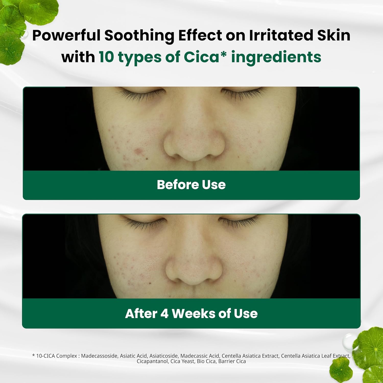 Buy now Dr.G Red Blemish Clear Soothing Korean Moisturizer Face Cream, 70ml - Cica Cream, Korean Skin Care Moisturizer, Korean Face Moisturizer, Facial Moisturizer, Korean Skincare, K Beauty Skincare Coreano at indiglob india