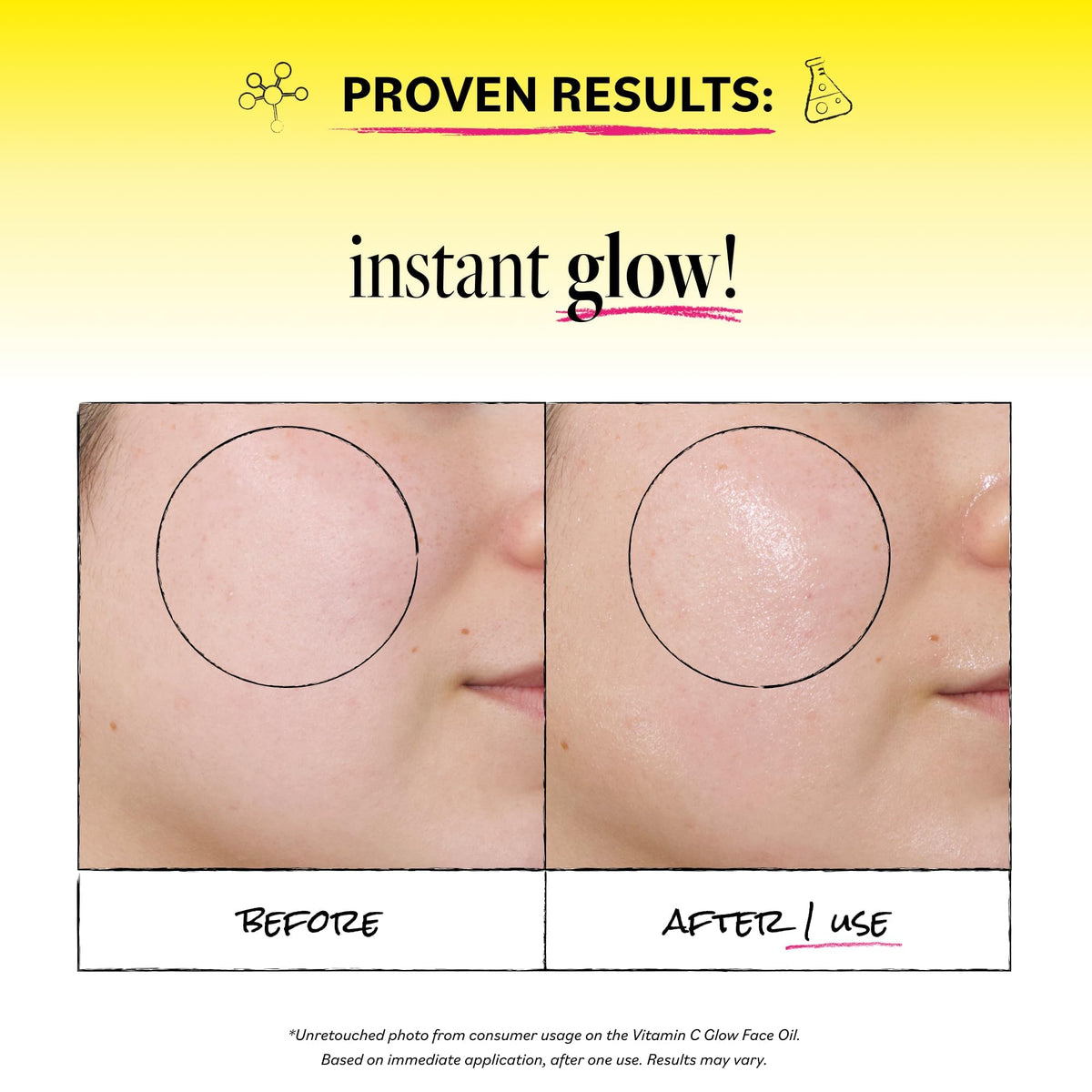 Derma E Vitamin C Glow Face Oil, 1 Fl Oz Vitamin C Oil with Turmeric