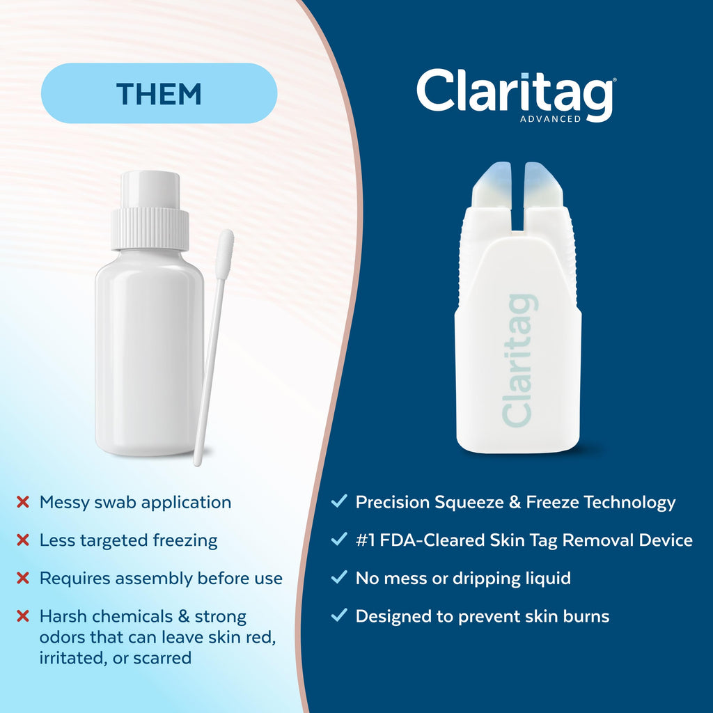Claritag Advanced Skin Tag Remover, FDA-Cleared Freeze-Off Kit