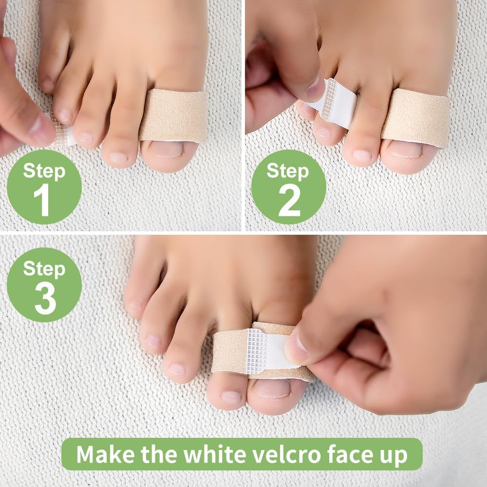 Niupiour Hammer Toe Corrector Buddy Wraps for Broken Toe and Bunion, 8 Pack