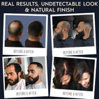 Hair Illusion Spray Applicator Removable Flat Tip designed to Spray Precise Hairline or Remove Tip For Round Sprayer And Wide Coverage (does not include hair fibers)