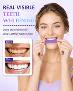 Teeth Whitening Strips, Purple Color-Correcting Technology, 14 Treatments