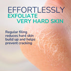 Dr. Scholl's Callus Remover Electronic Foot File, Electric Hard Skin Removal for Feet, Effortless Soft Smooth Skin in Minutes, Perfect for Travel, for Women & Men, AAA Batteries Included