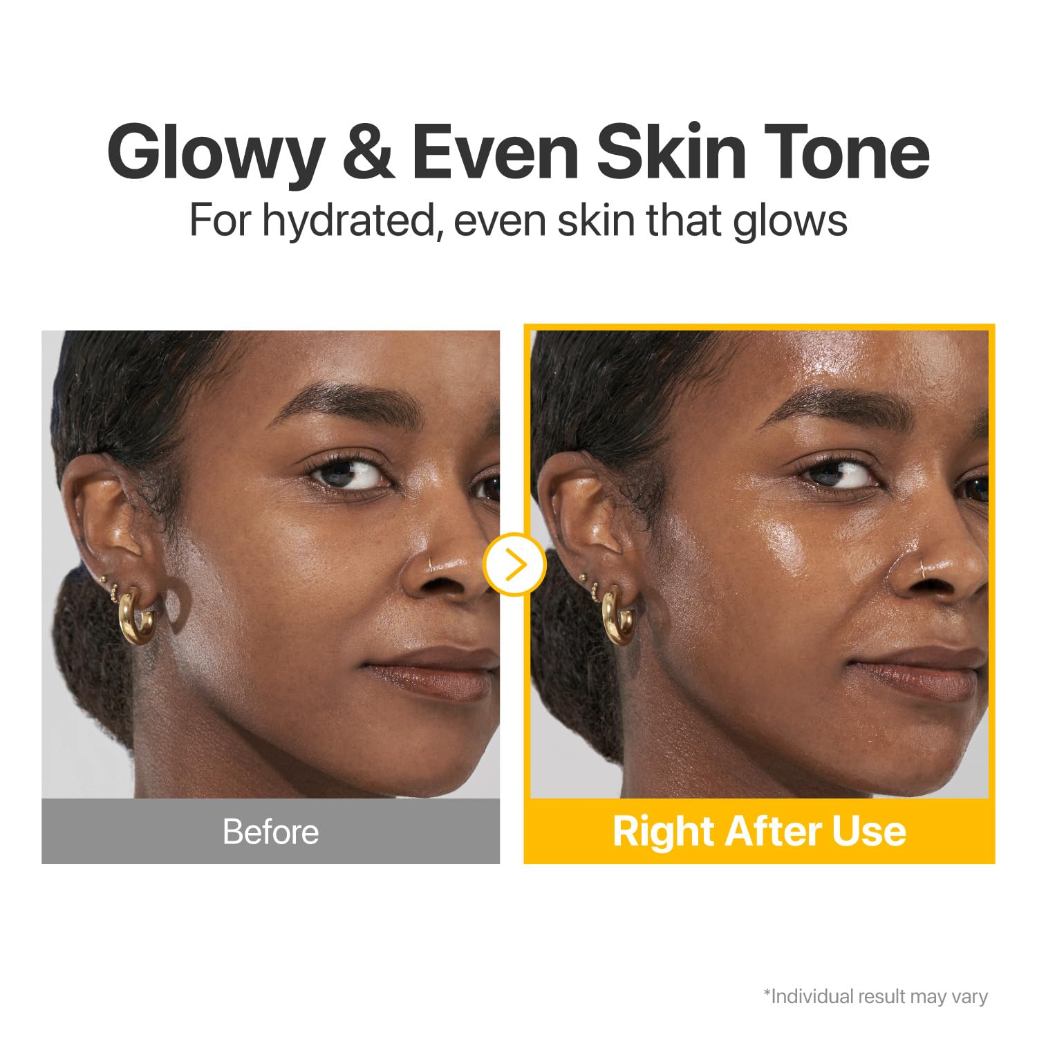 numbuzin No.5 Vitamin Concentrated Serum, Dark Spot Care, Glutathione & Vitamin Serum, Korean Skincare, Tranexamic Acid 4%, Niacinamide 5%, for a Radiant-Looking Glow 1.01 fl oz