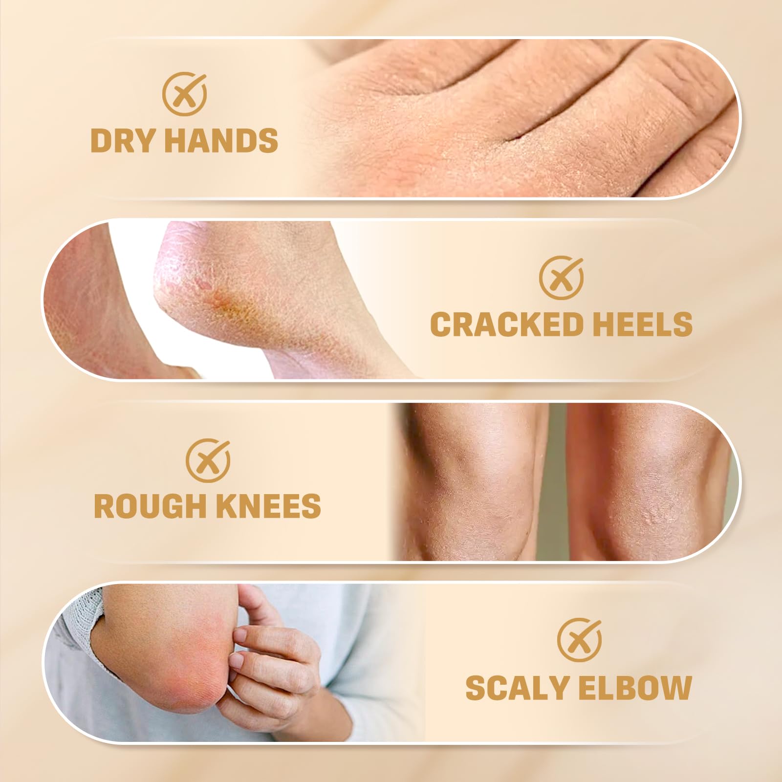 60% Urea Cream for Feet with 2% Salicylic Acid for Deep Hydration-150g | Urea Cream 60 Percent for Feet & Hands-Maximum Strength Moisturizer for Rough,Dry,Thick & Cracked Skin,Callus Remover