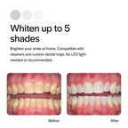 Buy now Opalescence 20% Teeth Whitening Refill Kit (4 Syringes) Carbamide Peroxide. Made by Ultradent, in Mint Flavor. Tooth Whitening Refill Syringes - B-5196-4 at indiglob india