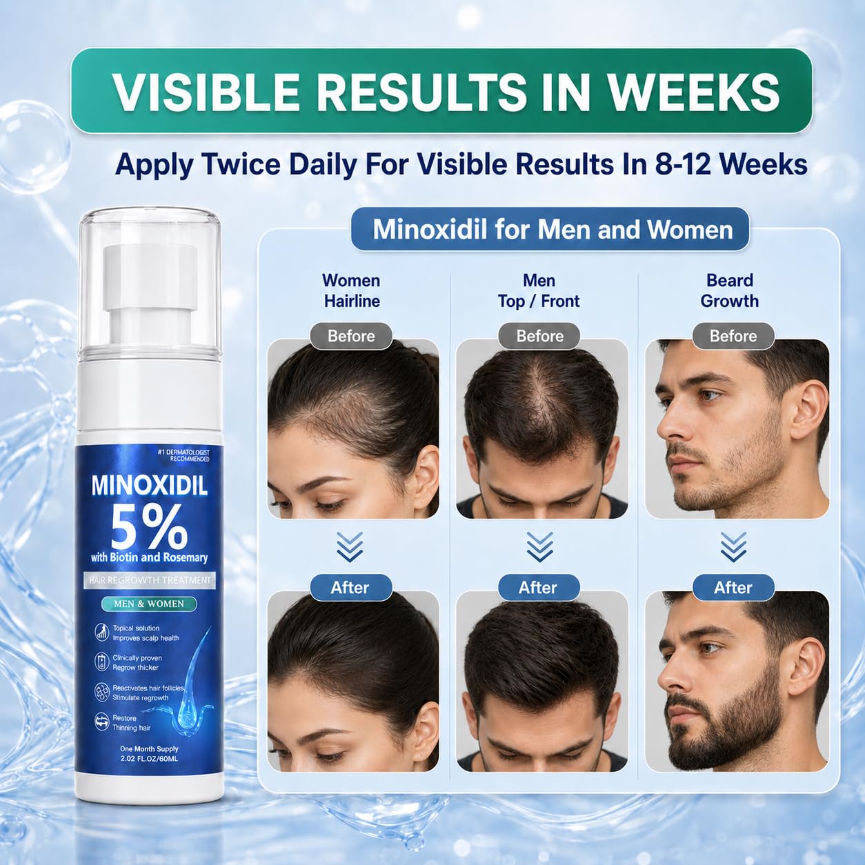 Minoxidil for Men and Women, Hair Growth Serum with Biotin, Rosemary and Batana for Hair Beard Regrowth Treatments Extra Strength Hair Loss Solution, Clinically Proven to Regrow Thicker, 60ML