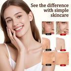 Beef Tallow for Skin - 100% Grass Fed Whipped Tallow and Honey Balm - Unscented, Non-Greasy Daily Face Moisturizer & Body Butter for Dry Sensitive Skin (5oz)