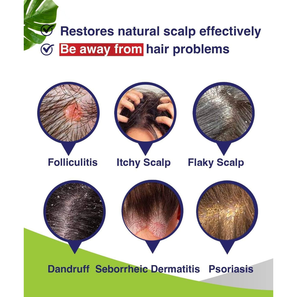 PHARMBANNER Anti-Fungal Shampoo for Folliculitis, Seborrheic Dermatitis, Scalp Psoriasis - Relieves Itchy & Dry Scalp