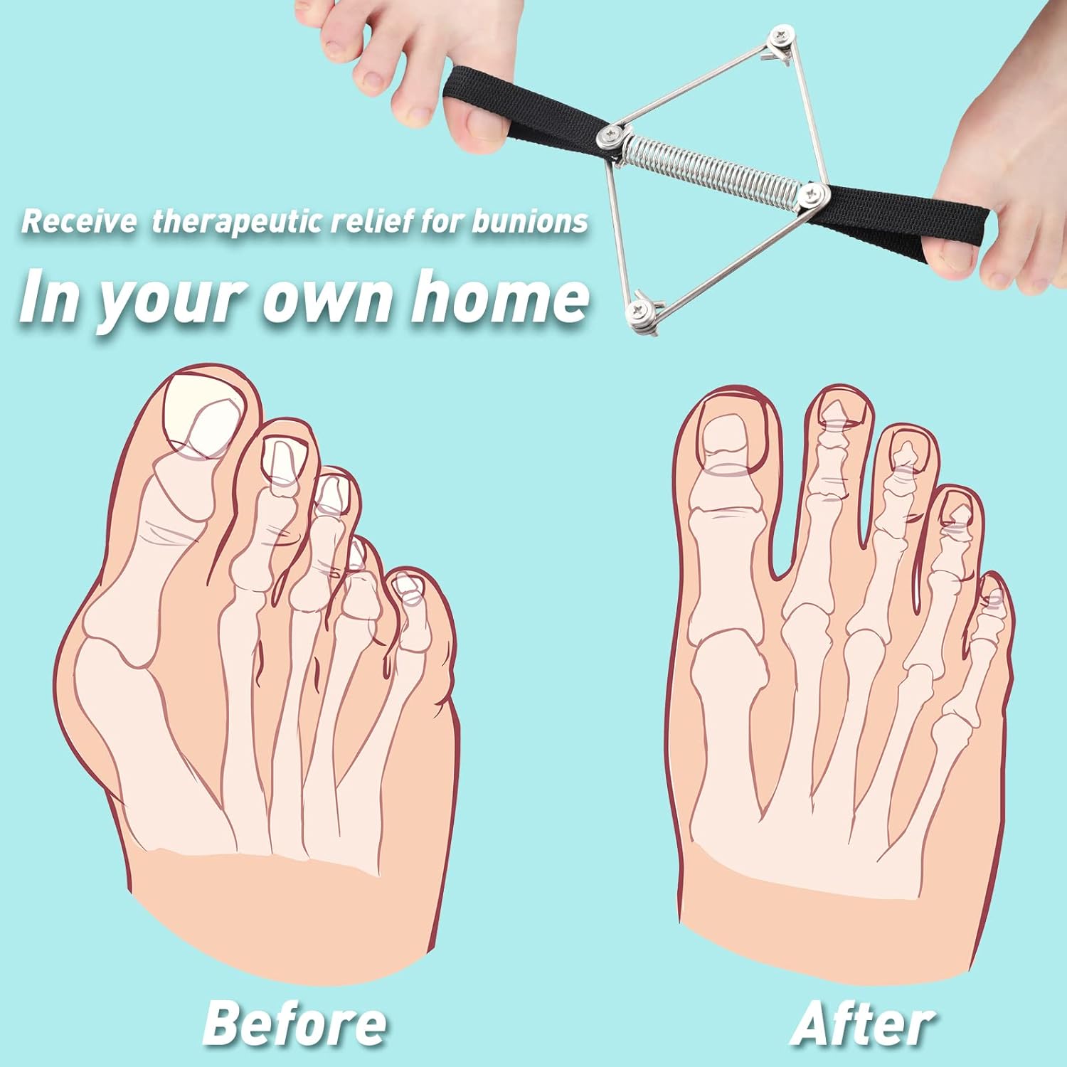 Buy now Pilates Toe Stretcher Bunion, Hallux Valgus Big Toe Strap Spacer Tension Bunion Exercise Band Stretchy Alignment Splint Restores Pain Relief for Women Men at indiglob india