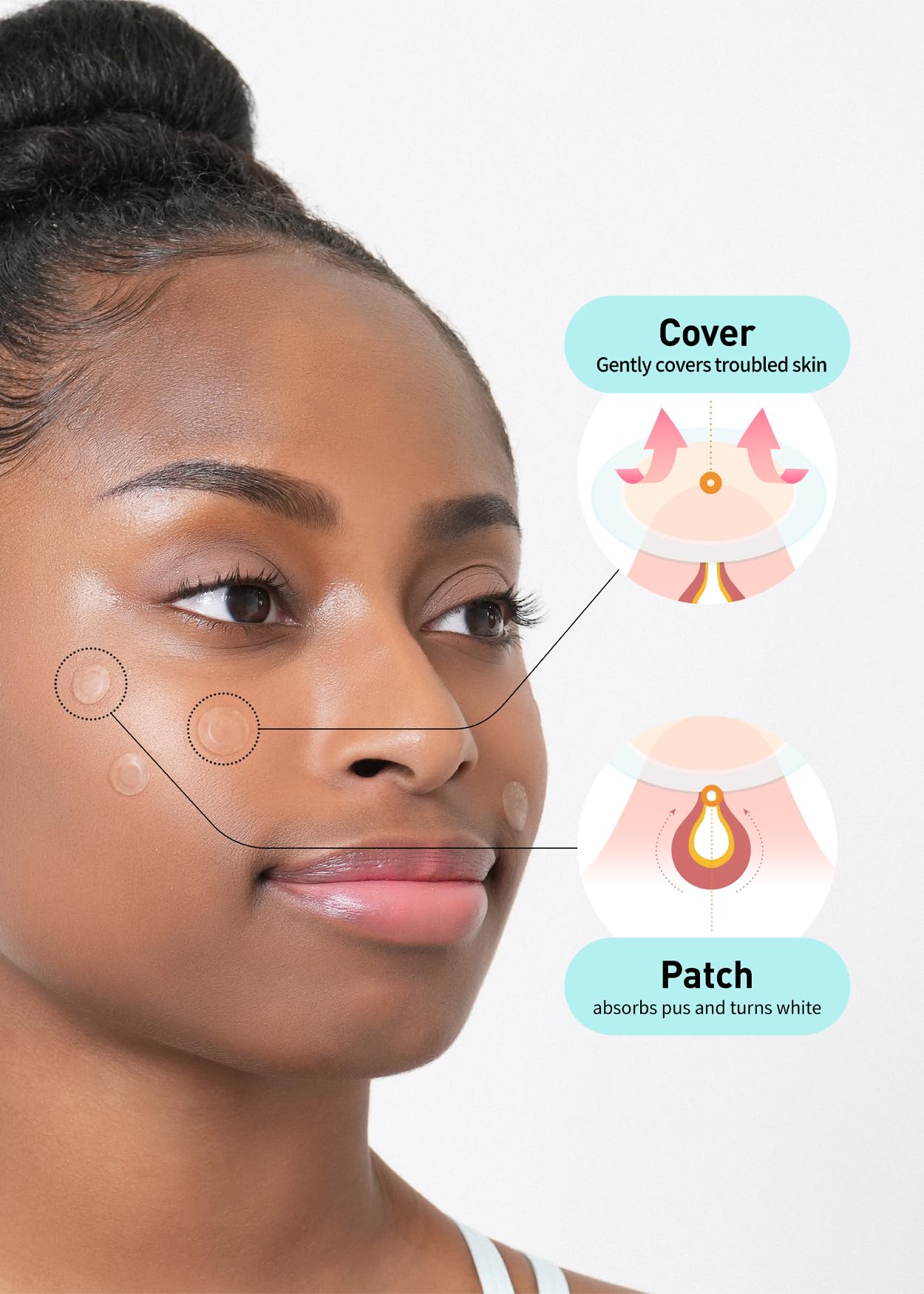 Buy now OLIVE YOUNG Care Plus Spot Patch Big (81 Count) | Hydrocolloid Patch, Spot Stickers for Acne Pimple and Zits at indiglob india