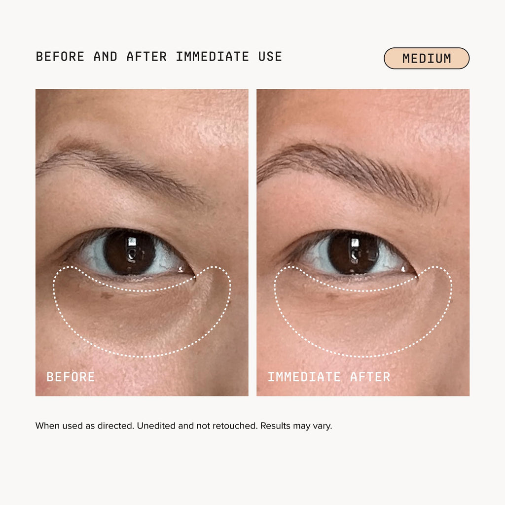 DRMTLGY Luminous Eye Corrector SPF 41 Medium | Undereye Corrector
