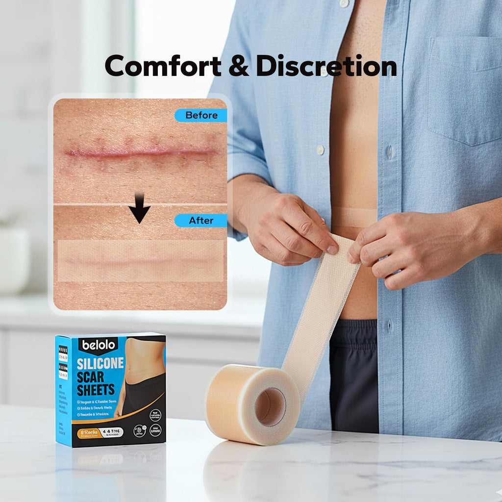 Silicone Scar Sheets (1.6" x 60" Roll - 1.5M), Silicone Scar Tape, Silicone Scar Sheets for Surgical Scars, Keloids & C-Section Scars, Reusable & Washable Scar Patches for Face & Body