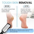 Colossal Foot rasp Foot File and Callus Remover. Best Foot Care Pedicure Metal Surface Tool to Remove Hard Skin. Can be Used on Both Wet and Dry feet, High Grade Stainless Steel File