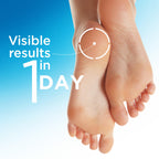 Flexitol Heel Balm Twin Pack, 25% Urea Cream for Dry Cracked Heels | 2x4 oz | Exfoliates & Moisturizes with Aloe, Vitamin E & Shea Butter, Visible Results in 1 Day, Diabetes-Friendly