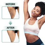 Skin Bleaching Cream Skin Lightening for Body Intimate Areas, Private Parts, Underarm, Knees, Elbows, Inner Thigh, Bikini Area, Whitening Cream Dark Spot Remover For Intimate Areas (1FL OZ)