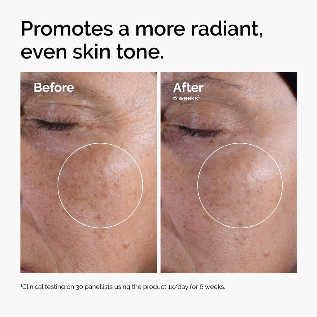 Buy now The Ordinary Glycolic Acid 7% Exfoliating Toner, Brightening and Smoothing Daily Toner for More Even-Looking Skin Tone at indiglob india