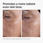 Buy now The Ordinary Glycolic Acid 7% Exfoliating Toner, Brightening and Smoothing Daily Toner for More Even-Looking Skin Tone at indiglob india