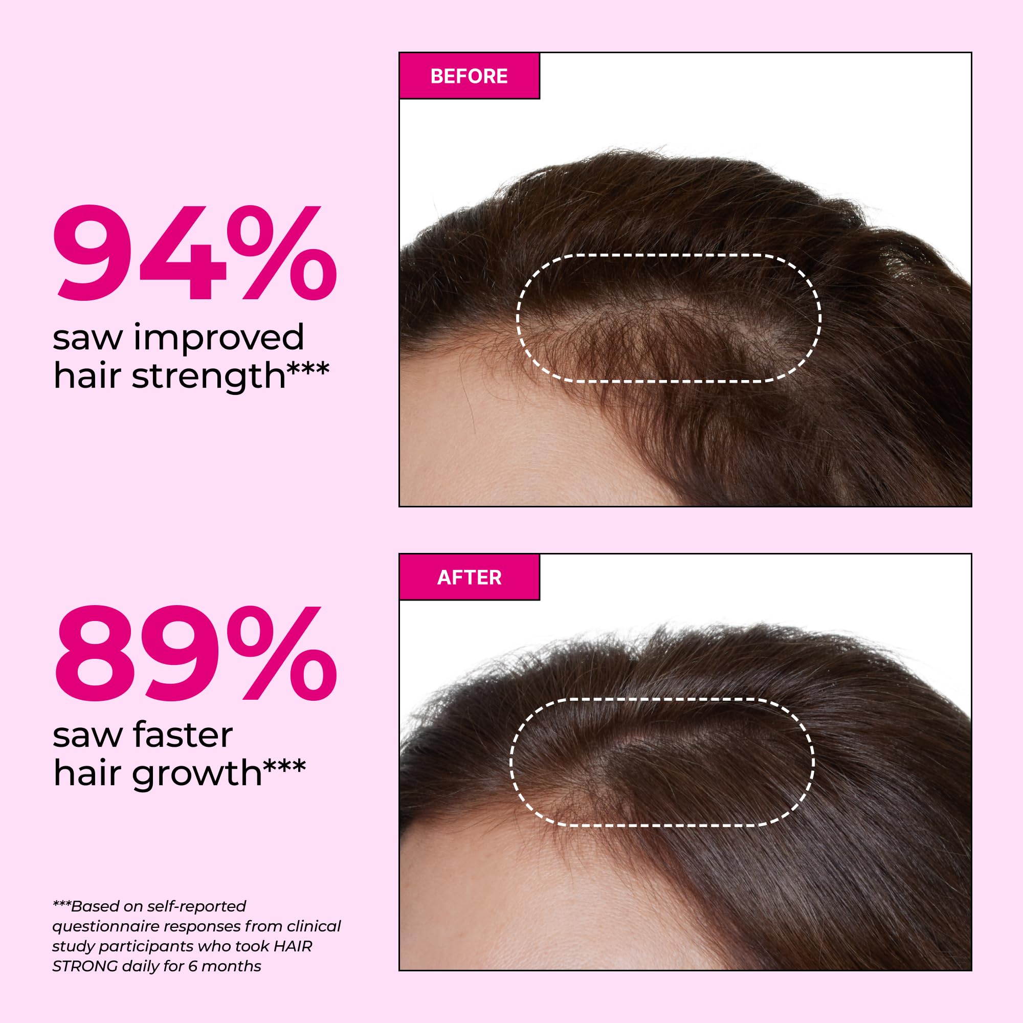 HUM Hair Strong Gummies Biotin, Zinc & Vitamin B12, Hair Growth, 60 Count | Folic Acid, Fo-Ti Root Extract, Biotin & Zinc, Vegan Strawberry Gummies, 3-Month Supply, Non-GMO