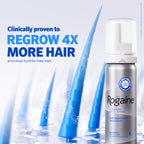 Men's Rogaine 5% Minoxidil Foam, 1-Month Supply, 2.11 oz | Fuller, Thicker Hair Regrowth, Topical Hair Loss Treatment, Unscented Topical Aerosol