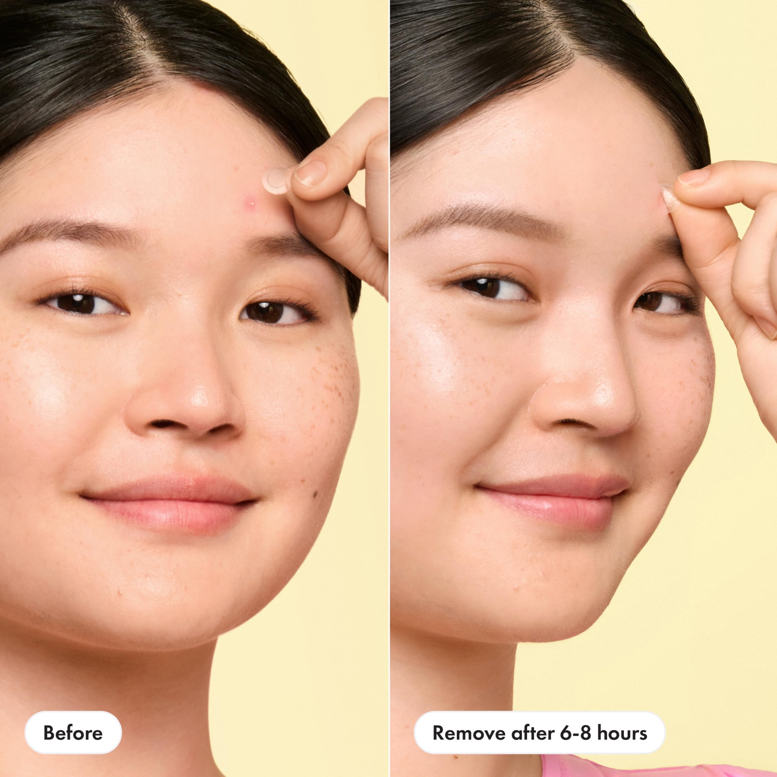Hero Cosmetics Mighty Patch Mini Invisible+ Acne Pimple Patches, 30 Ct | X-Small 10mm, Daytime Hydrocolloid Acne Patches, for Covering Zits & Blemishes, Blends Into Skin & Barely There