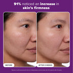Buy now Paula's Choice CLINICAL 1% Retinol Face Treatment with Peptides, Vitamin C & Licorice Extract, Anti-Aging Skin Care Serum, Fine Lines & Wrinkles, Fragrance Free at indiglob india