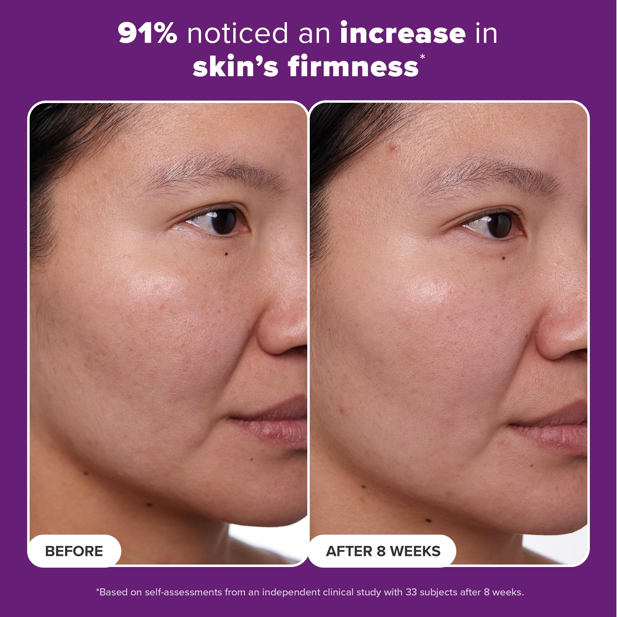 Buy now Paula's Choice CLINICAL 1% Retinol Face Treatment with Peptides, Vitamin C & Licorice Extract, Anti-Aging Skin Care Serum, Fine Lines & Wrinkles, Fragrance Free at indiglob india