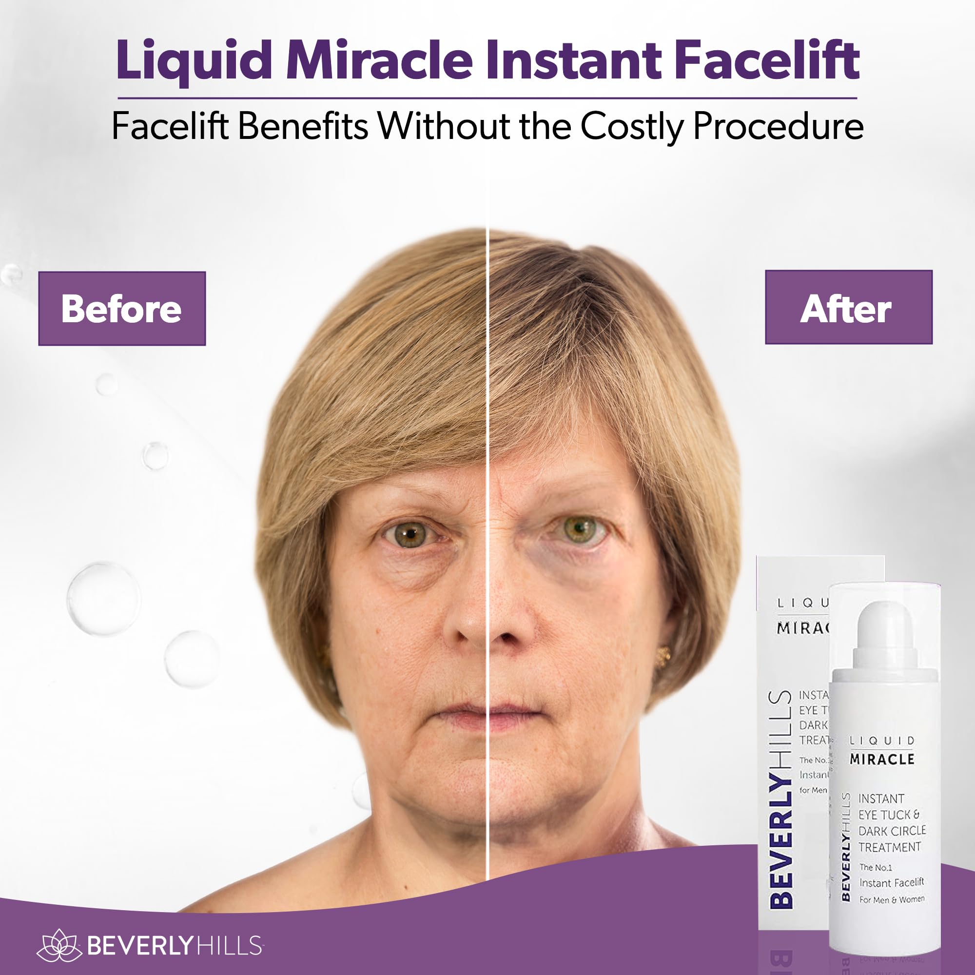 Buy now Beverly Hills Instant Facelift Anti Aging Eye Serum Treatment for Dark Circles, Puffy Eyes, Wrinkles, Under Eye Bags, Fine Lines, and Crows Feet | 30mL (120 Days Supply) at indiglob india
