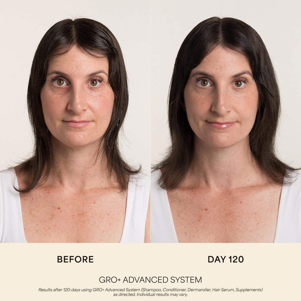 VEGAMOUR GRO+ Advanced Balancing Shampoo, MD-Formulated, Color Safe
