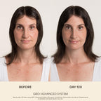 VEGAMOUR GRO+ Advanced Balancing Shampoo, MD-Formulated, Color Safe