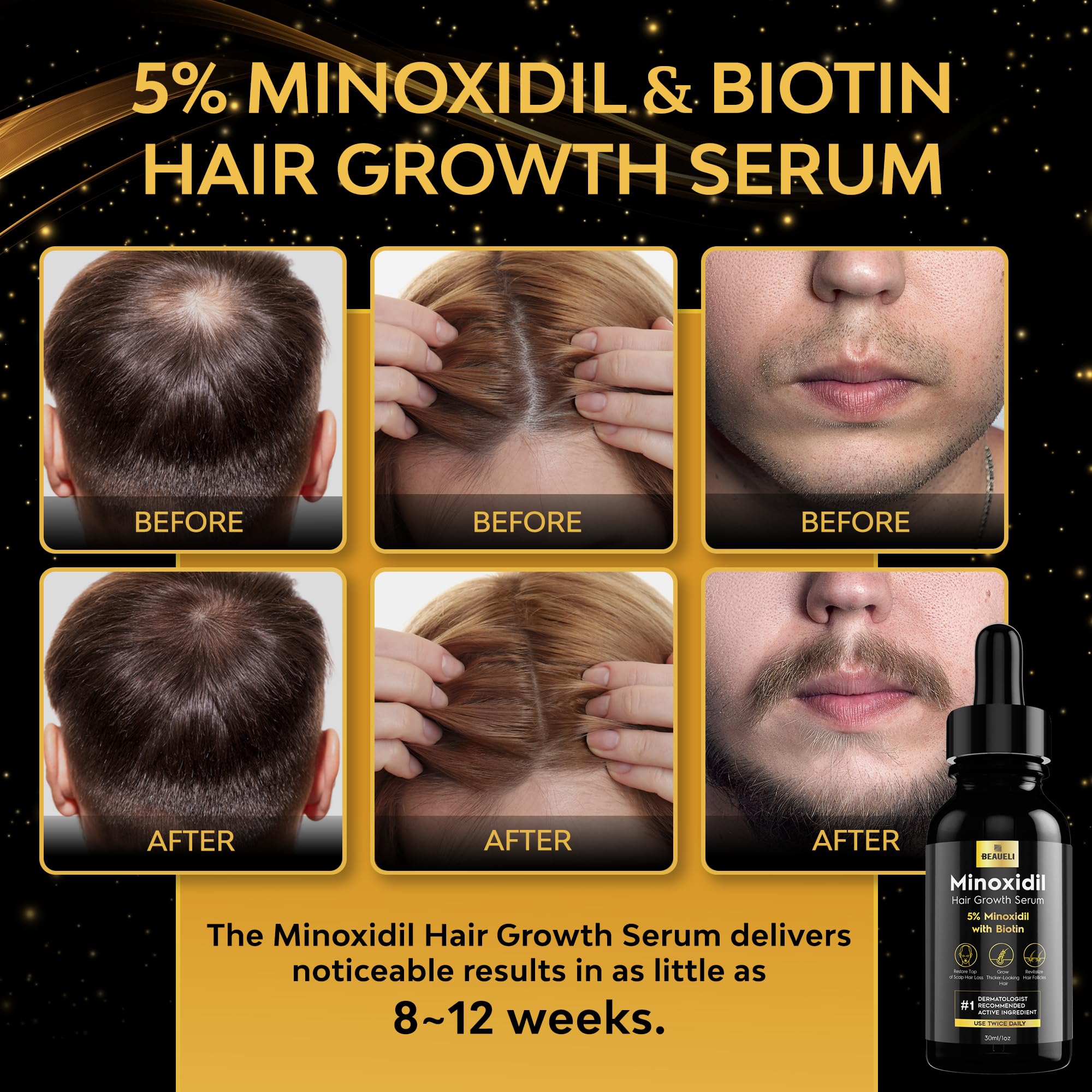 Beaueli 5% Minoxidil for Men and Women, Hair Growth, Beard Growth, Hair Regrowth, Unscented Drop, 3 Fl Oz, 3 Bottles | Minoxidil Hair Growth Oil for Men & Women, 5% Minoxidil Serum Hair Regrowth Treatment with Biotin for Thicker, Fuller Hair