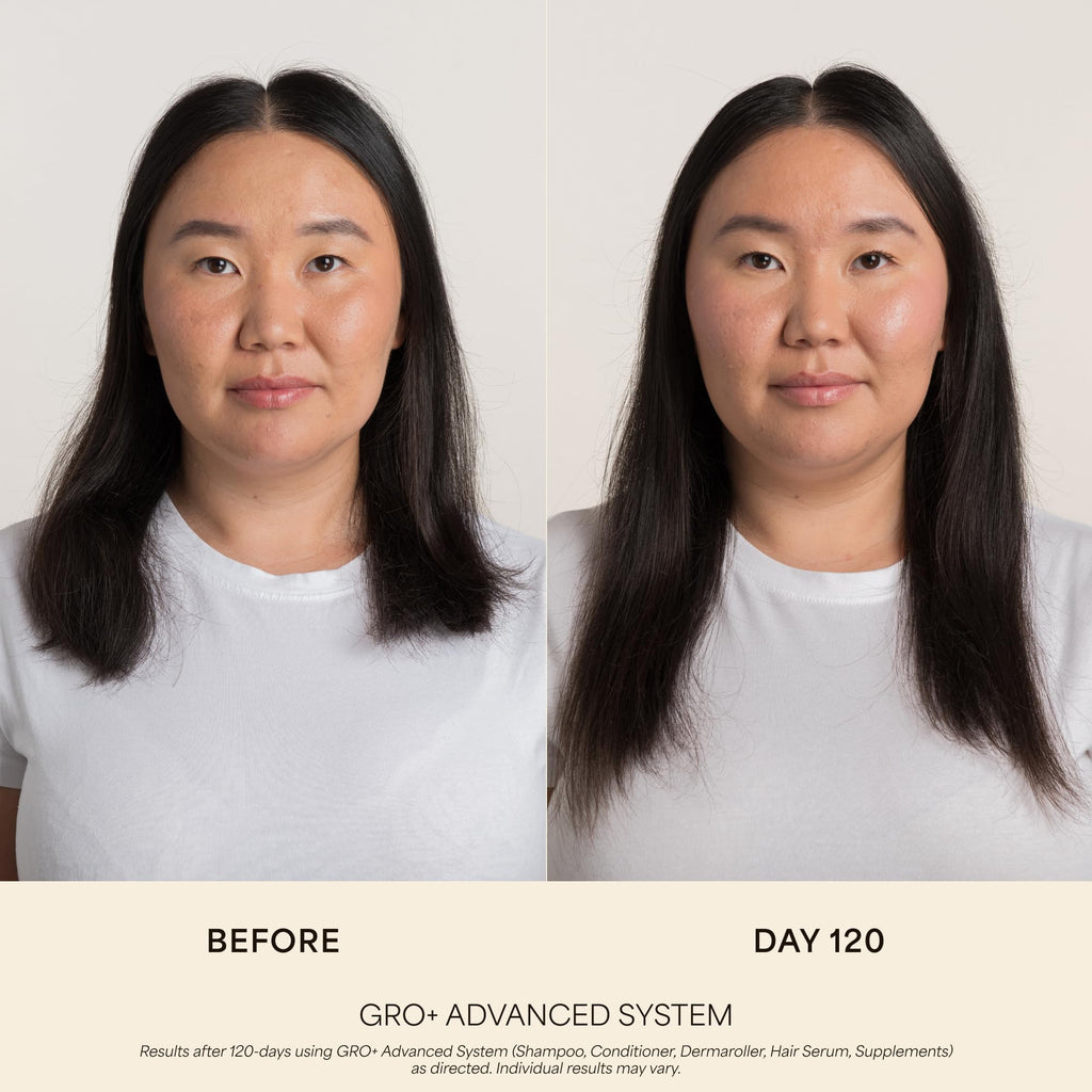 VEGAMOUR GRO+ Advanced Balancing Shampoo, MD-Formulated, Color Safe