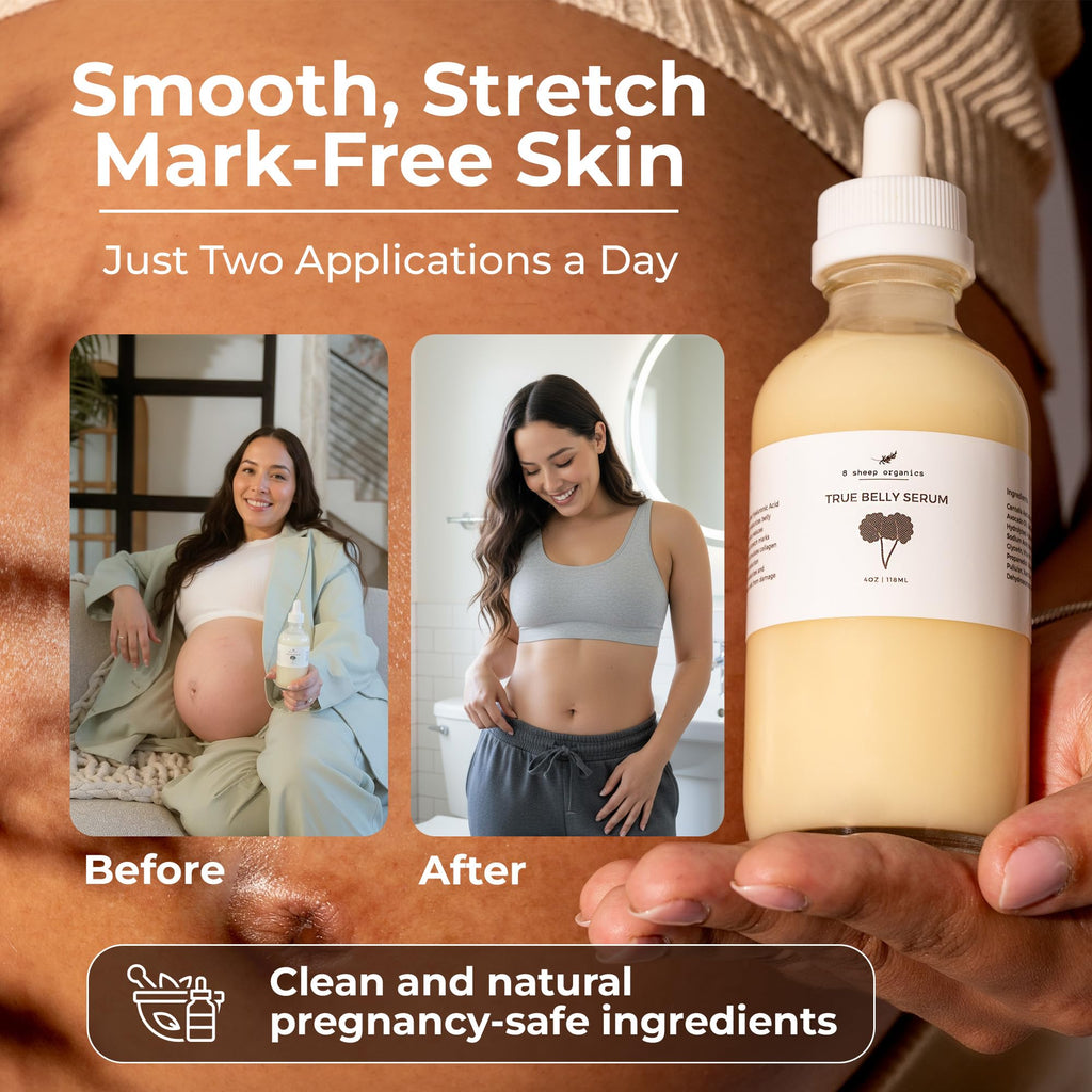 8 Sheep True Belly Serum, Pregnancy-Safe Skin Care Belly Oil with Triple-Weighted Hyaluronic Acid & Centella Asiatica, Supports Hydration & Skin Elasticity, Made in USA in Small Batches, 4 FL OZ