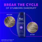 Head & Shoulders Clinical Strength Advanced Oil Control Anti-Dandruff Shampoo Twin Pack, 1% Selenium Sulfide, 13.5 fl oz Each