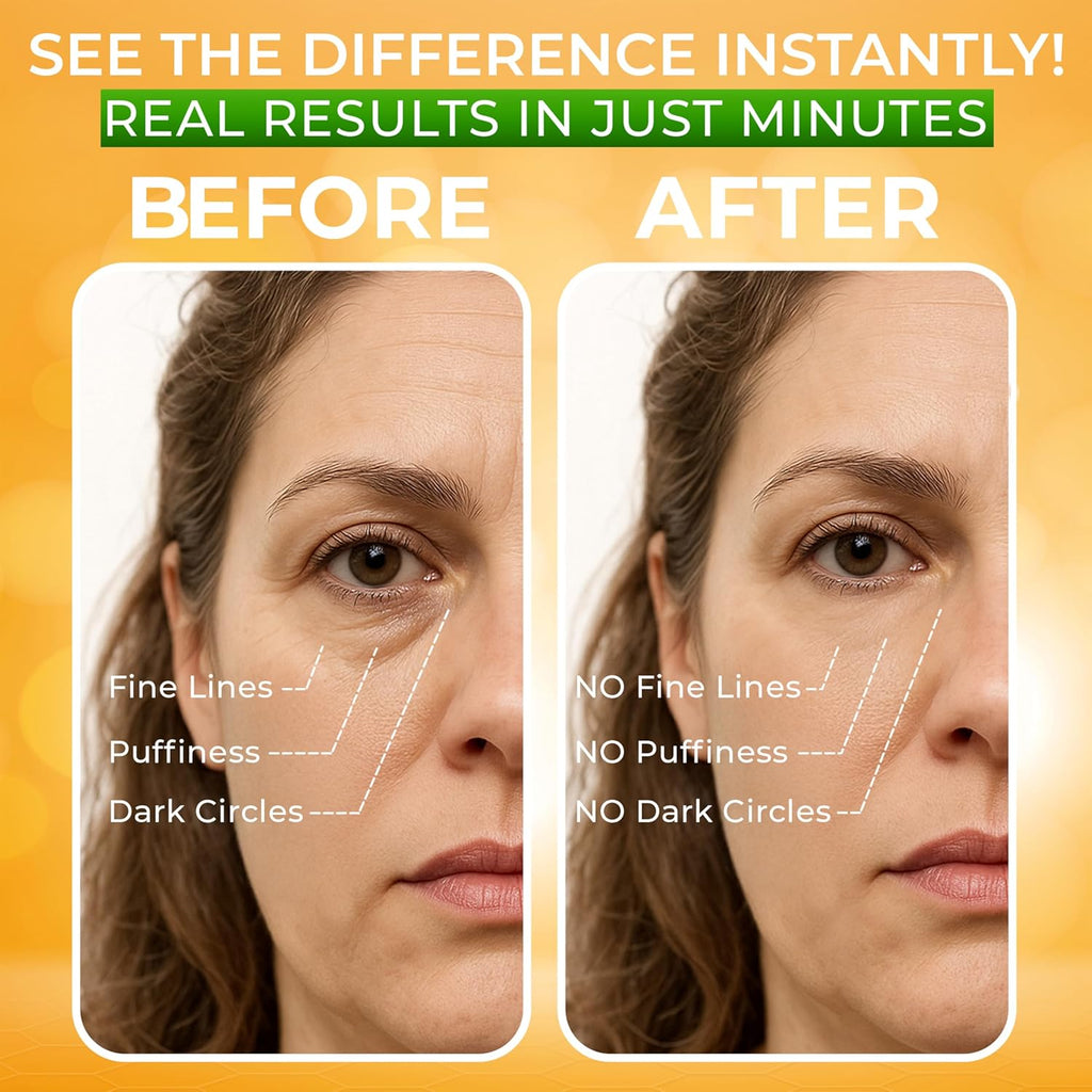Buy now Puffy Eye Treatment Instant results â€“ Naturally Eliminate Wrinkles, Puffiness, Dark Circle and Bags in Minutes â€“ Hydrating Eye Cream w/ Green Tea Extract, Dead Sea Minerals by SEAMANTIKA â€“ .8 fl.oz. at indiglob india