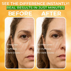Buy now Puffy Eye Treatment Instant results â€“ Naturally Eliminate Wrinkles, Puffiness, Dark Circle and Bags in Minutes â€“ Hydrating Eye Cream w/ Green Tea Extract, Dead Sea Minerals by SEAMANTIKA â€“ .8 fl.oz. at indiglob india
