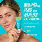Good Molecules 10% Azelaic Acid Treatment for Face – Blurs Facial Redness & Evens Skin Tone – Brightens the Look of Dark Spots & Refines Texture – Vegan & Fragrance-Free Skincare (30ml / 1.01 fl oz.)