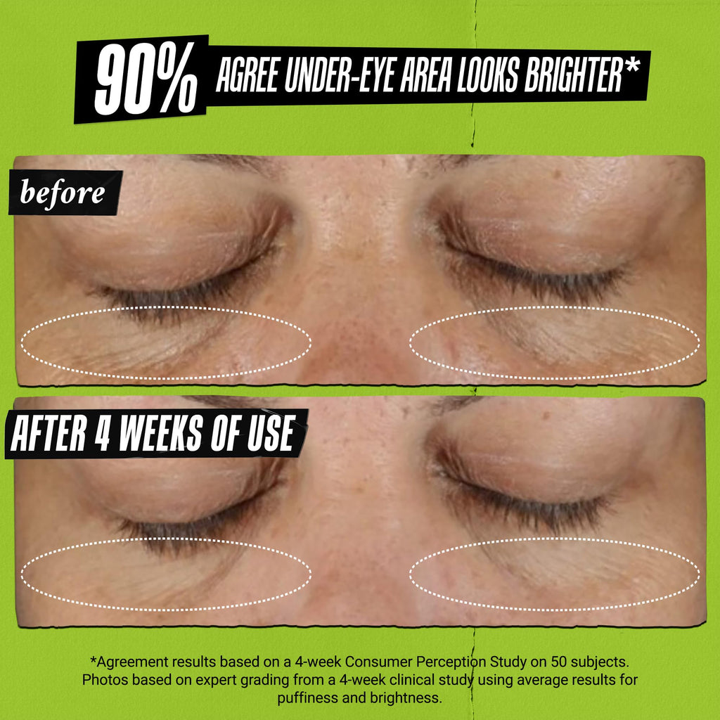 Kiehl's - Avocado Eye Treatment, for Dry Lines & Puffiness | Under Eye Cream with Avocado Oil & Caffeine - Daily Hydrating, Depuffing, and Smoothing Eye Treatment