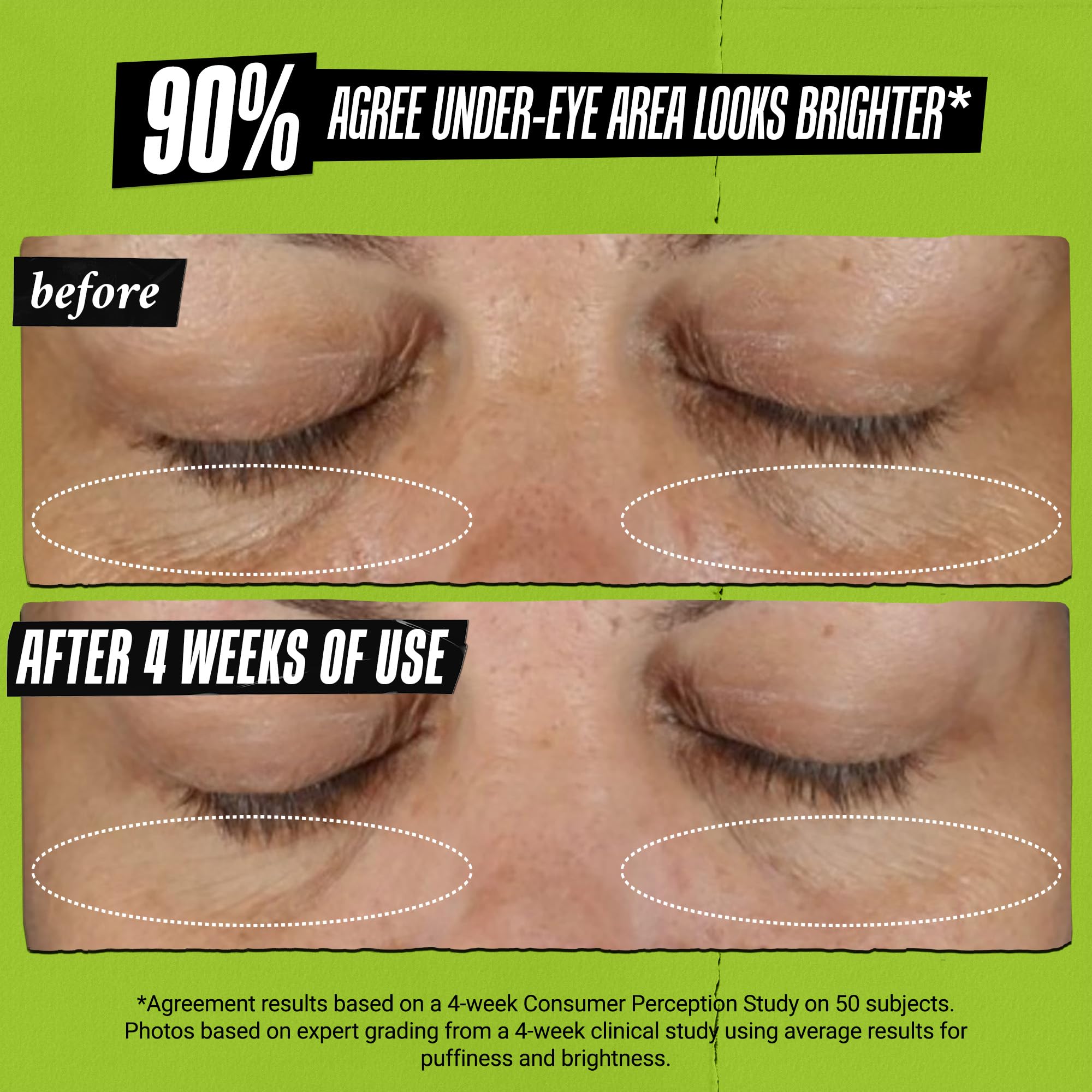 Kiehl's - Avocado Eye Treatment, for Dry Lines & Puffiness | Under Eye Cream with Avocado Oil & Caffeine - Daily Hydrating, Depuffing, and Smoothing Eye Treatment