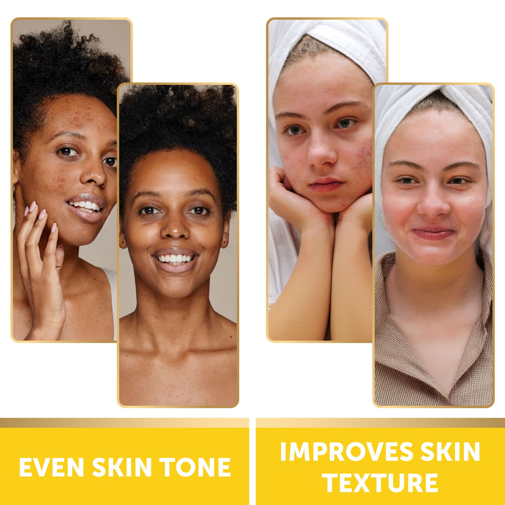 VALITIC Turmeric and Kojic Acid Cleansing Pads for Dark Spots 60 Units