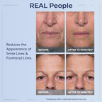 Plexaderm Rapid Reduction Serum - Visibly Reduces Under-Eye Bags & Wrinkles | Instant eye serum that visibly reduces under-eye bags, puffiness, wrinkles & dark circles in minutes, lasting up to 10 hours