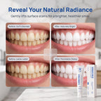 Shryske Toothpaste Whitening, Shryske Toothpaste for Yellow Teeth