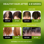 Batana Oil for Hair Growth - 100% Raw & Organic Unrefined Batana Oil - Cold Pressed Hair Mask for Scalp Health, Thicker Hair & Split Ends Repair - Natural & Pure (4.23 oz)