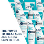 CeraVe Foaming Acne Cream Cleanser, Face Wash with 4% Benzoyl Peroxide, 5oz | Skin Care, Hyaluronic Acid, Niacinamide, Facial Cleanser, Acne Treatment For Face, Face Care, Gentle Cleanser, Ceramides