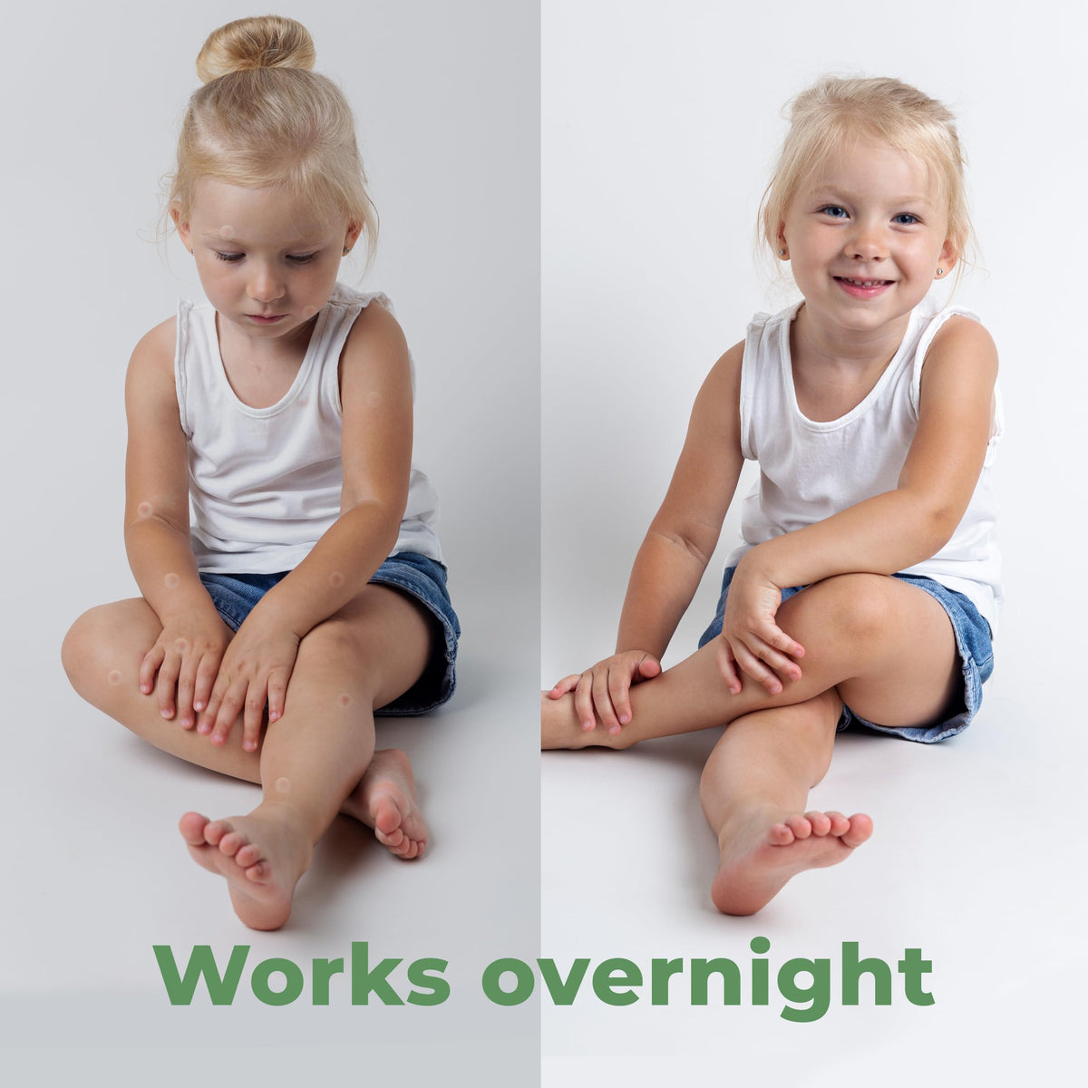 Bug Bite Patches (60 Pack) Mosquito Bite Itch Relief for Kids (Hydrocolloid, Aloe Vera & Witch Hazel, Mosquito Patches for Skin, Bug Bite Itch Relief Stickers for Insect Bites (Skin Friendly)