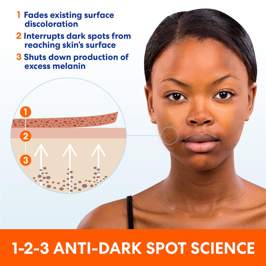 Palmer's Anti Dark Spot Face Cream with Vitamin E & Niacinamide (2.7 Oz) | Fade Cream Helps Reduce Dark Spots and Age Spots, Evens Skin Tone & Balances Complexion, Suitable for All Skin Types