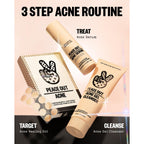 PEACE OUT Acne Healing Dots Hydrocolloid Pimple Patches (60 count) | Fast Acting Acne Spot Treatment for Blemishes & Breakouts with Salicylic Acid, Retinol and Aloe Vera, Award Winning Skincare