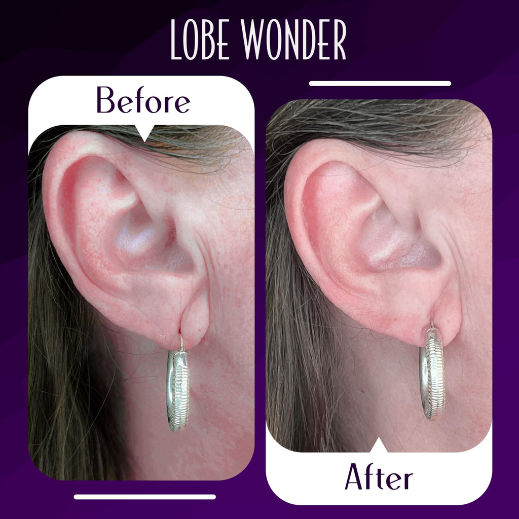Lobe Wonder The ORIGINAL Earring Support Patches – 60 Clear & Latex-Free